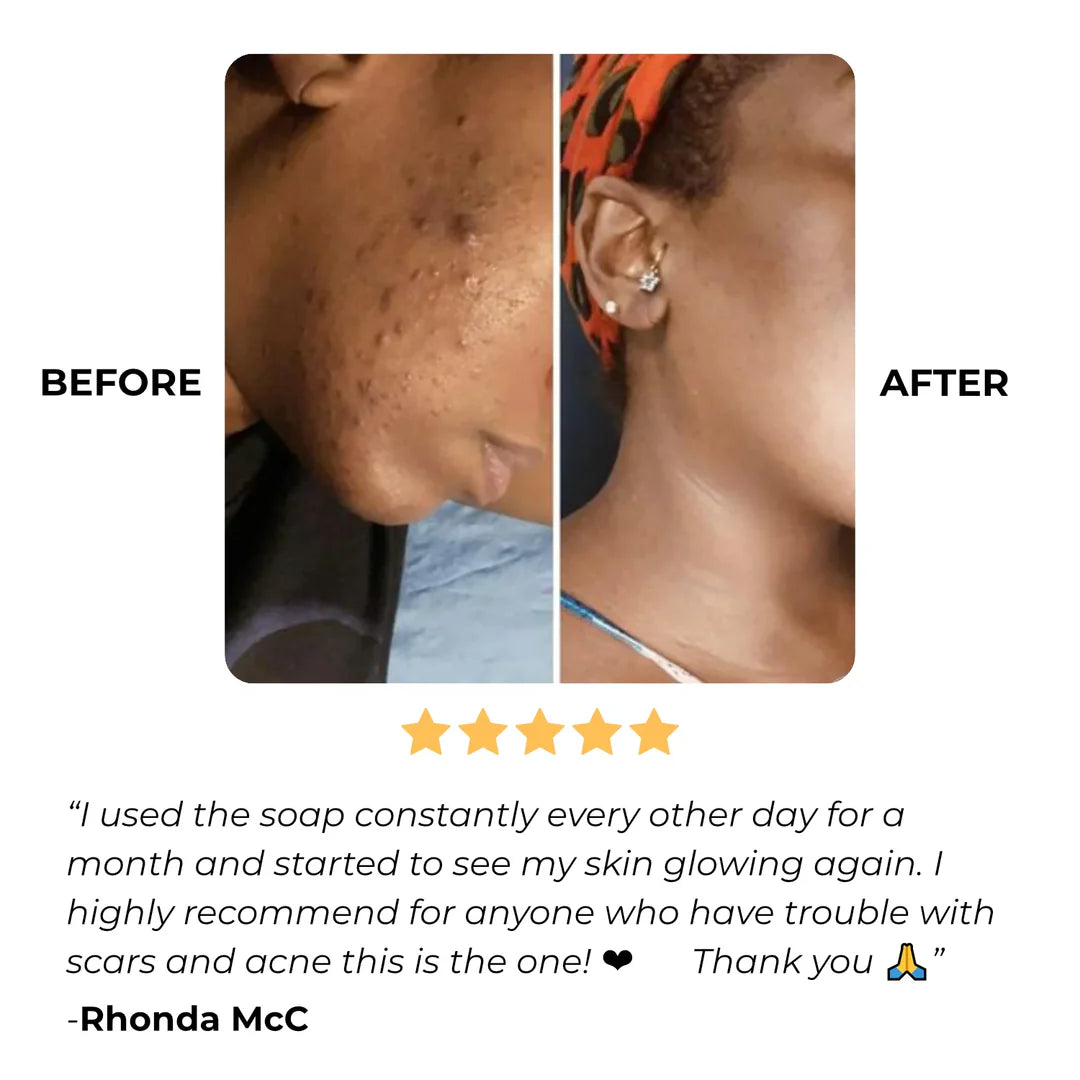 Hwang & Beauty Turmeric & Kojic 3-in-1 Radiance Skincare Set