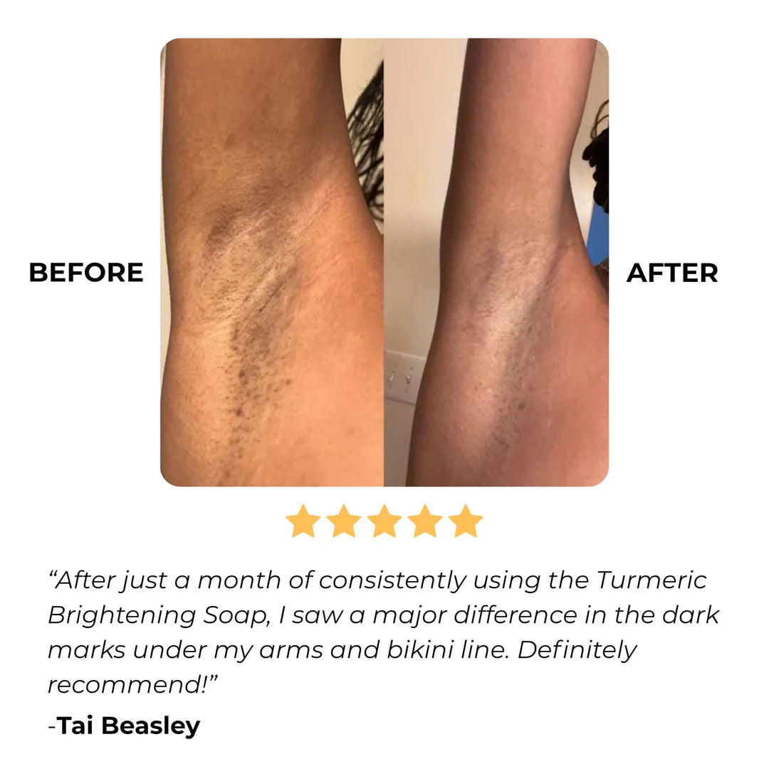 Hwang & Beauty Turmeric & Kojic 3-in-1 Radiance Skincare Set